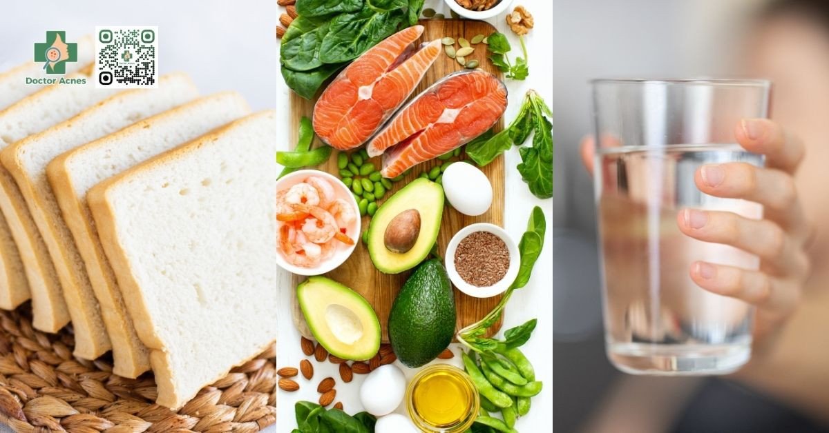 Chế độ ăn uống lành mạnh và cân bằng giúp kiểm soát mụn hiệu quả