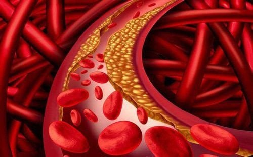Bác sĩ đang tư vấn về nguy cơ bệnh tim mạch liên quan đến mức cholesterol cao, nhấn mạnh tầm quan trọng của việc kiểm soát lượng chất béo bão hòa nạp vào cơ thể
