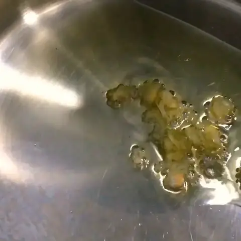 Cách Nấu Cháo Gan Gà Cho Bé Ăn Dặm Đủ Dinh Dưỡng & An Toàn Cách Nấu Cháo Gan Gà Cho Bé Ăn Dặm Đủ Dinh Dưỡng & An Toàn