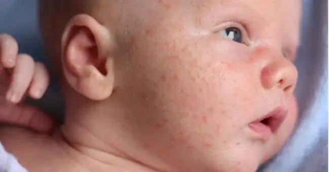 Hướng dẫn cách nấu hạt kê tắm cho bé an toàn và hiệu quả