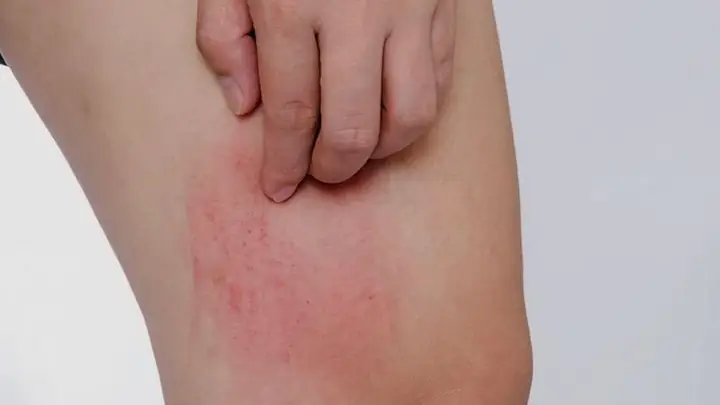 Hướng Dẫn Cách Nấu Lá Bồ Công Anh Khô Đơn Giản Tại Nhà