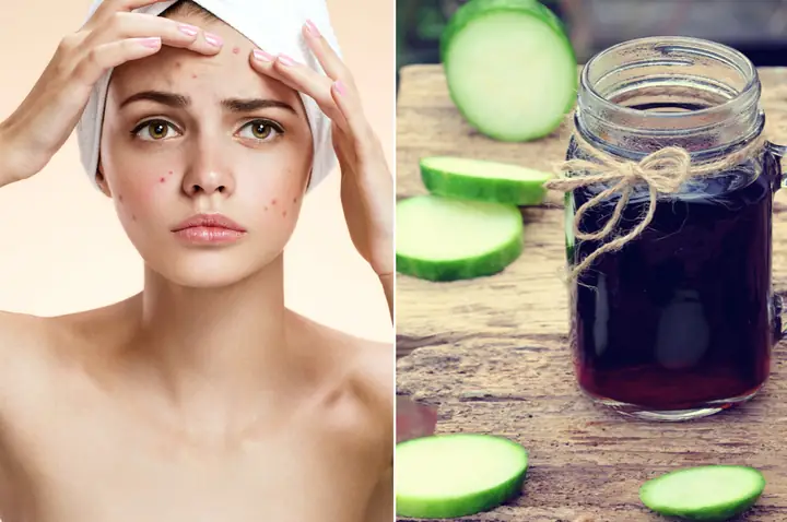 Hướng dẫn chi tiết cách nấu nước bí đao trị mụn và dưỡng da