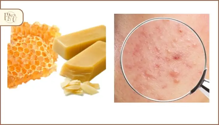 Hướng Dẫn Chi Tiết Cách Nấu Sáp Ong Tại Nhà Thành Công