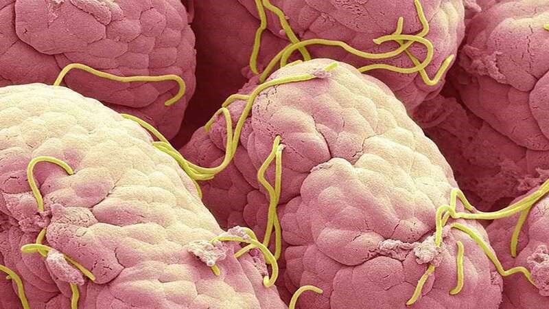 Đảm bảo thịt được chiên chín kỹ để tiêu diệt mọi ký sinh trùng gây hại.