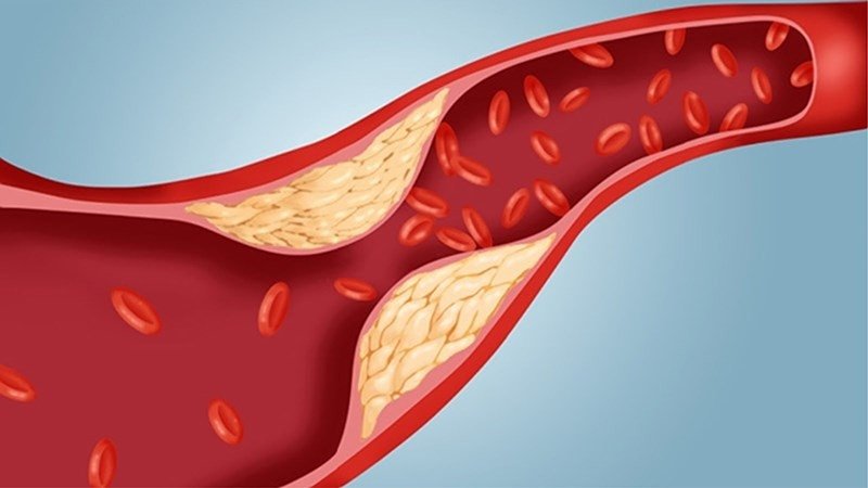 Món gà rán hấp dẫn, biểu trưng cho lượng cholesterol