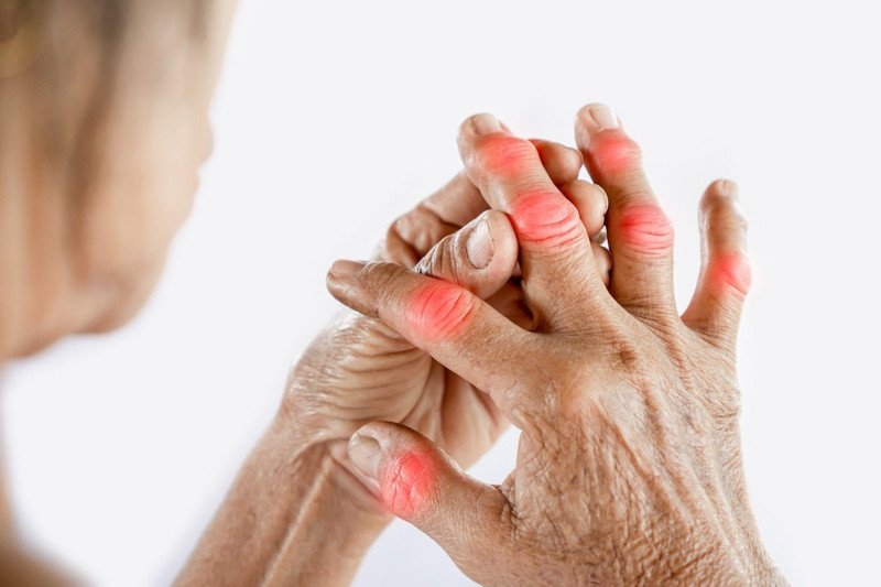 Những đối tượng cần thận trọng khi tiêu thụ mỡ cá tra, đặc biệt là người bệnh gút.