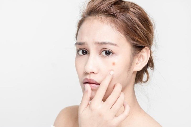 Thịt bò khô có thể ảnh hưởng đến quá trình lành mụn