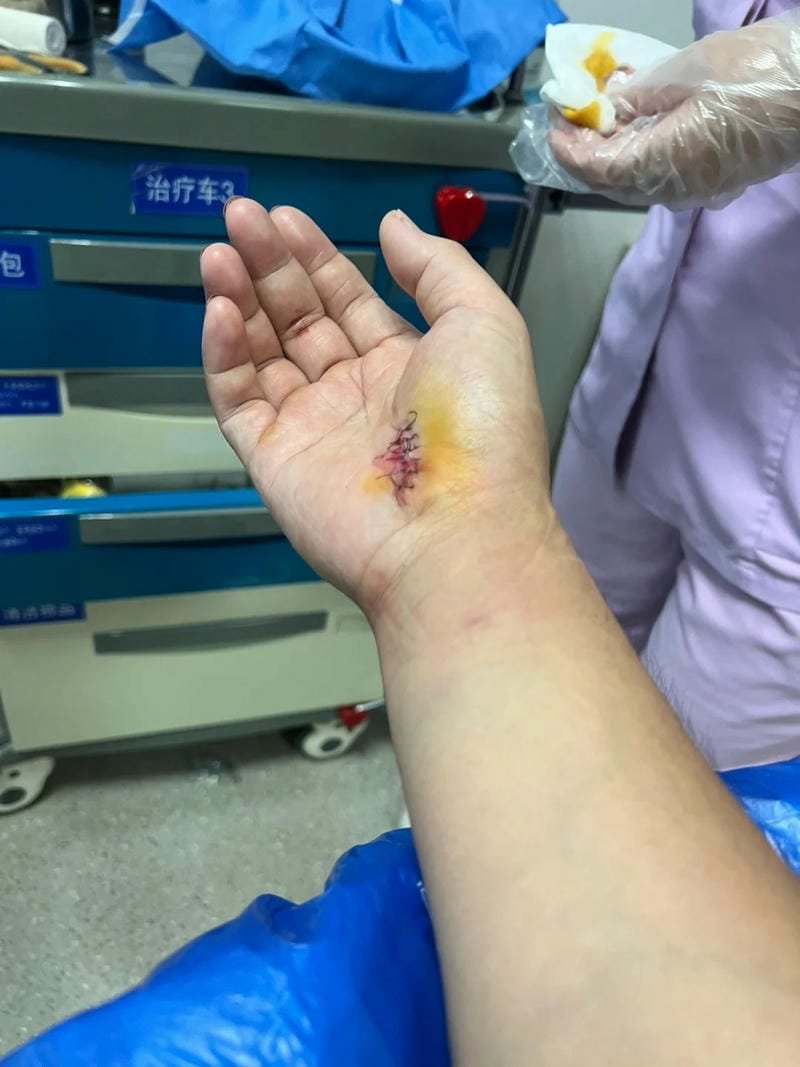 ảnh ngã xe 18