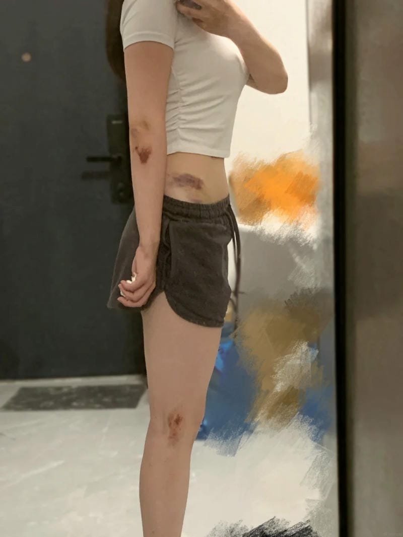 ảnh ngã xe 22