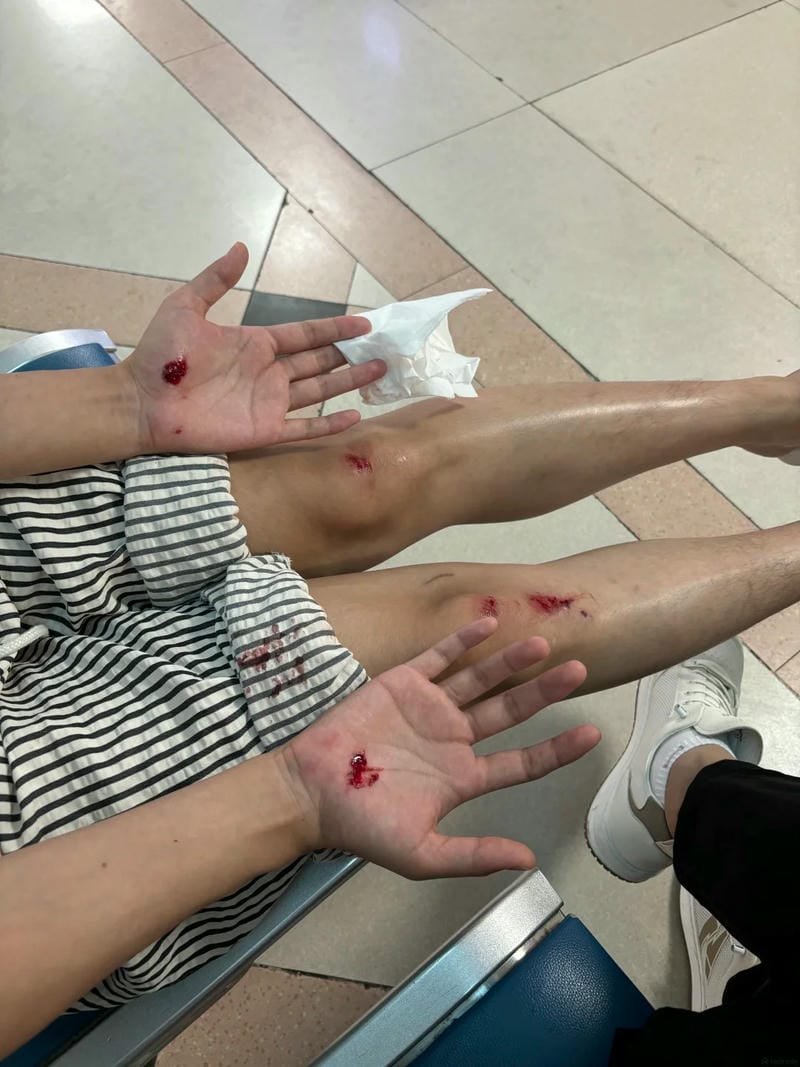 ảnh ngã xe 24