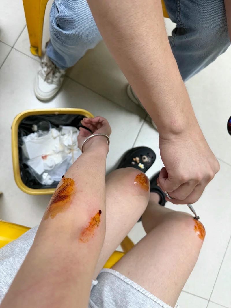 ảnh ngã xe 28