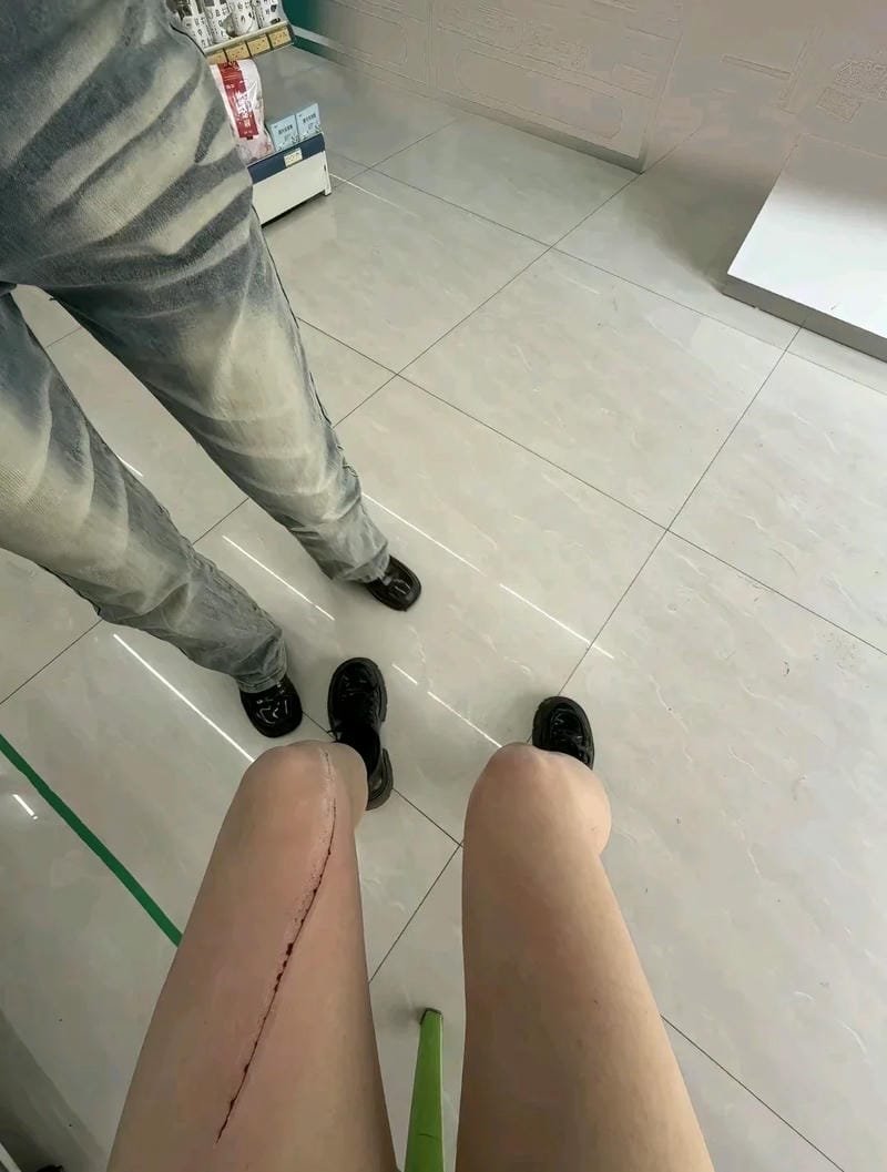 ảnh ngã xe 36